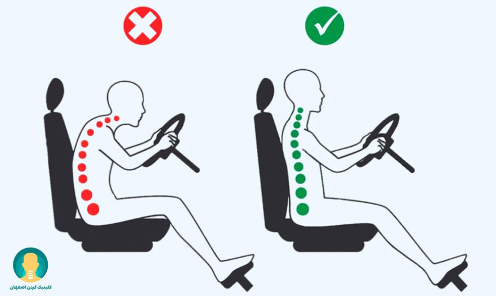 نشستن طولانی‌مدت در ماشین می‌تواند باعث گرفتگی گردن شود.