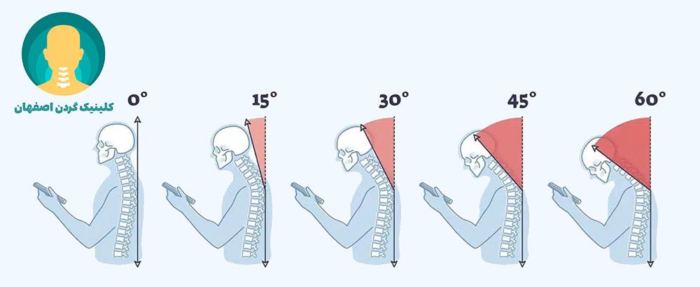 نحوهٔ صحیح استفاده از موبایل