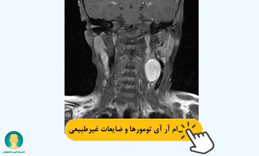 ام آر آی تومورها و ضایعات غیرطبیعی