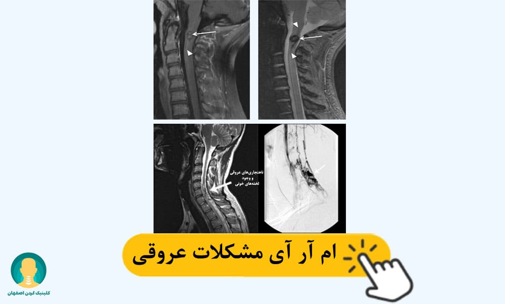 ام آر آی مشکلات عروقی