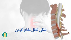تنگی کانال نخاعی گردن