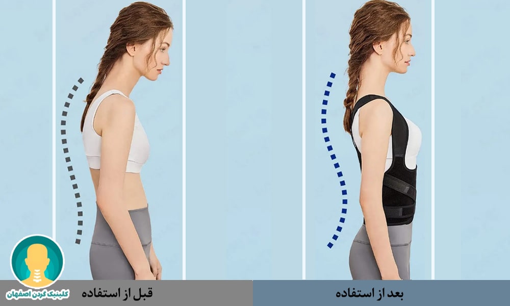 قوزبند طبی