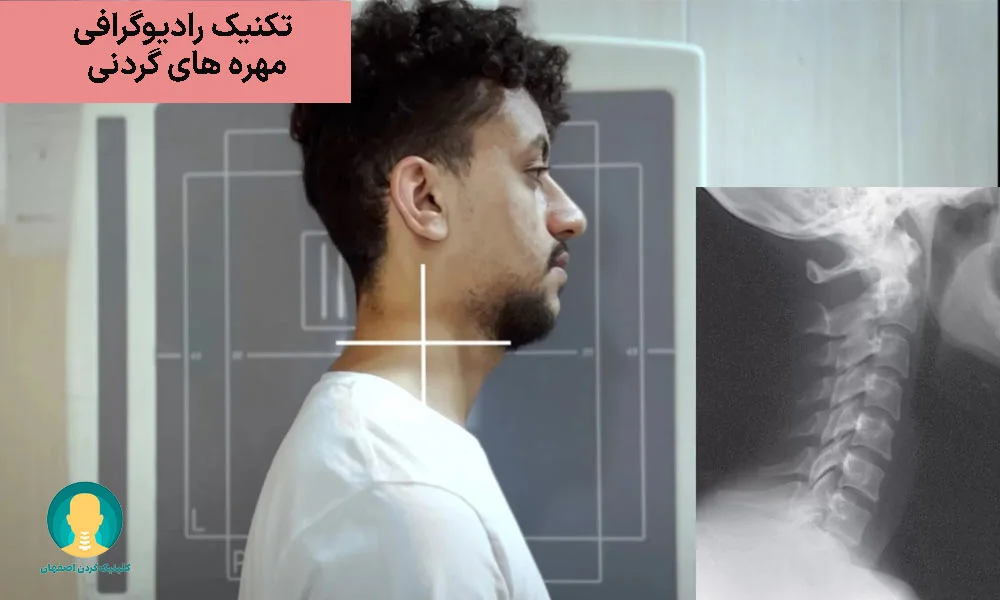 تکنیک رادیوگرافی مهره های گردنی